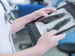 The AI-based technology uses X-ray to compare scans to a database of around 3,000 images, belonging to patients with COVID- 19.